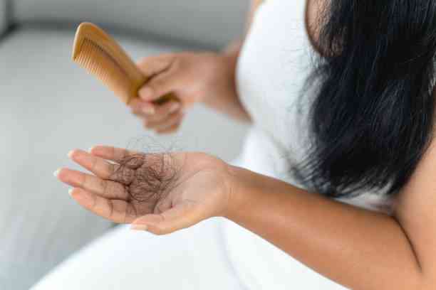 Penyebab Rambut Rontok Mulai Terungkap, Gaya Hidup hingga Stres Jadi Faktor Utama